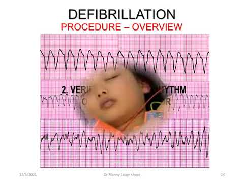 Dr Manny Learn shop Pediatric Life support part 2 Advanced Life Support