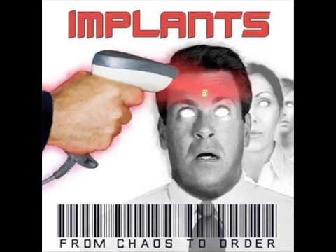 Implants - El Ron