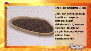Tıbbi Bitkiler - Üzerklik Tohumu - TRT DİYANET