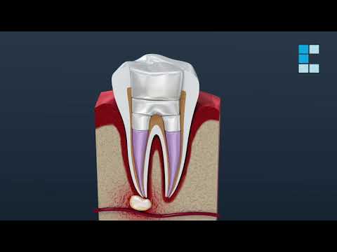 Colomer Dental - ENDODONCIA