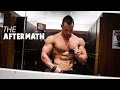 THE AFTERMATH | Chest Workout | Skin Cancer Checkup