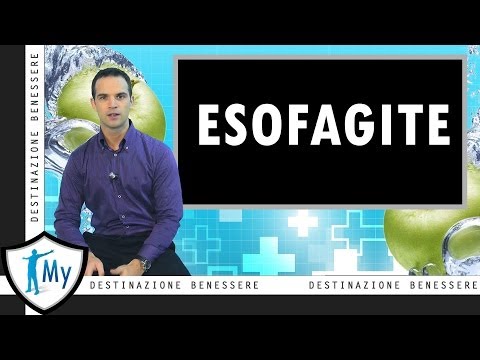 Esofagite