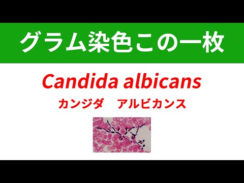 看護学科 今日のグラム染色この一枚 Candida albicansによる菌血症
