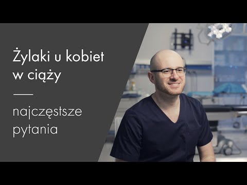 Żylaki u kobiet w ciąży – najczęstsze pytania