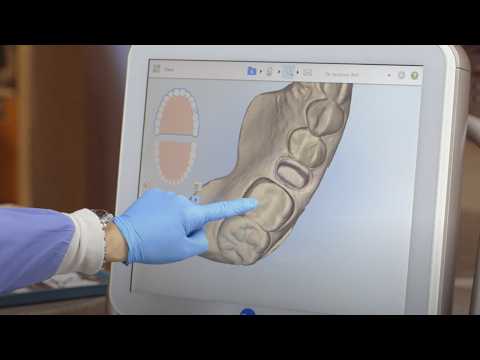 itero Element Intraoral Scanner Restorative Training