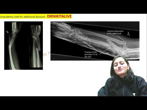 Mnemonic of the day - Galeazzi vs Monteggia fracture |Named fracture |Ortho mnemonics| Dr. Nikita
