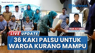 Baitul Mal Aceh dan RSUDZA Salurkan 36 Kaki Palsu untuk Warga Kurang Mampu di Aceh