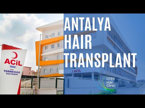 Transform Your Look with Expert Hair Transplant Solutions in Antalya!