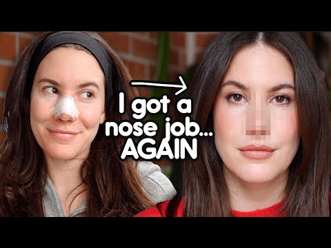 I Got (Another) Nose Job 👀 | My Revision Rhinoplasty Journey & Recovery Vlog