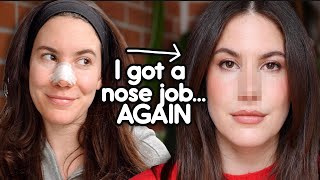 I Got (Another) Nose Job | My Revision Rhinoplasty Journey & Recovery Vlog