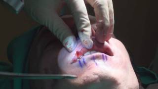 Dr. Philip Young