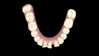 Ortodoncia Invisalign en Valencia - Clínica Peydro.wmv - Clínica Dental Peydro Herrero