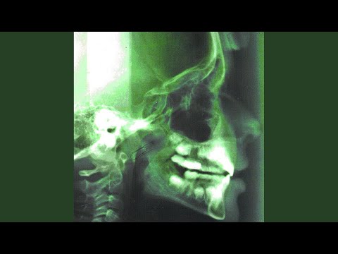 010 video thumbnail