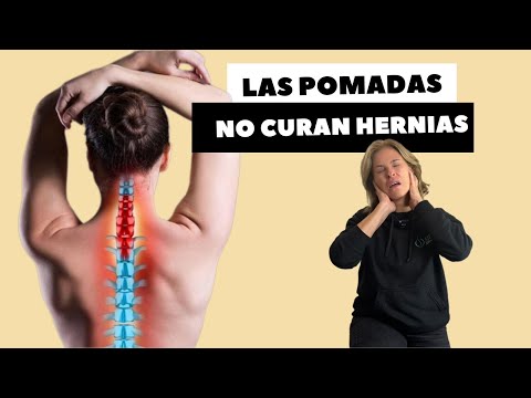 LAS POMADAS NO CURAN HERNIAS
