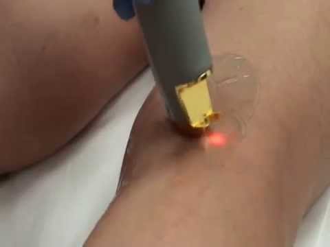 comment traiter jambes lourdes