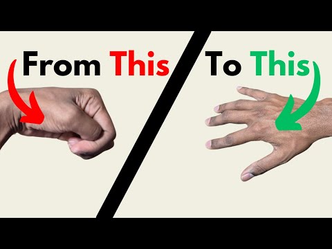Self Stretching For Hand Spasticity - Stroke Recovery Exercise