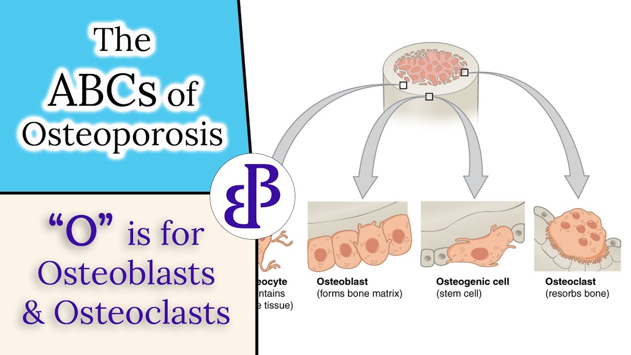 O is for Osteoblasts and Osteoclasts - The ABCs of Osteoporosis