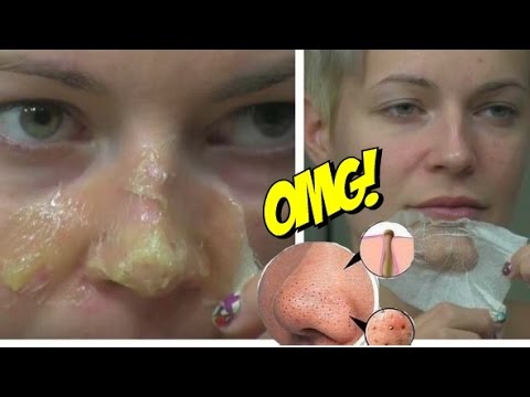 Przepis włosy maska łopian żółtko Szkody dla włosów z oleju rycynowego