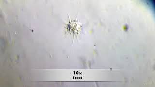 Download the video "Amoeba in its floating form (speed-up)"