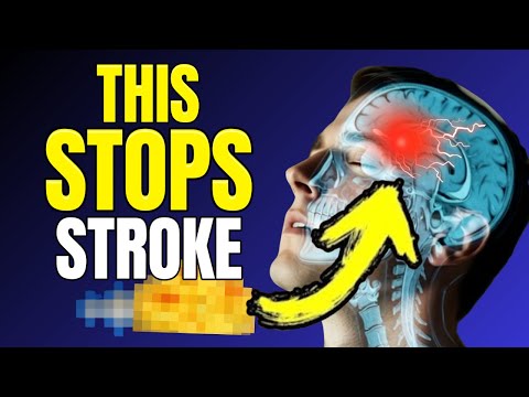 STROKE: You Have 4 HOURS to Do THIS (Or You Lose Your Brain)