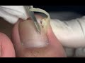 Curved nail cutting