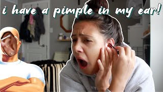 how to get rid of a pimple in your ear!