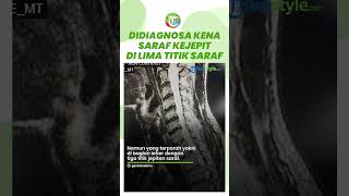 Ganindra Bimo Didiagnosa Saraf Kejepit di Lima Titik Saraf, Terparah di Bagian Leher