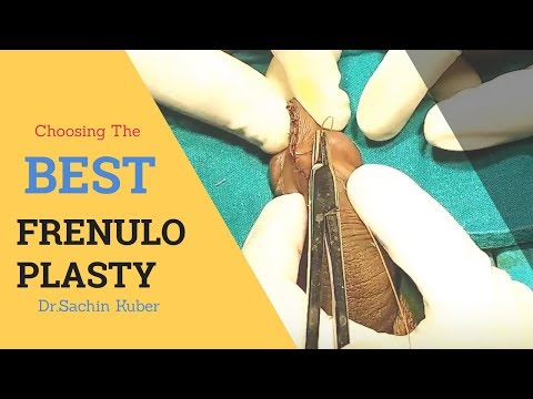 Tomat dan potensi Efek steroid pada potensi