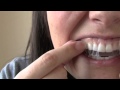 How to get Whiter teeth in 2 hours! | Kandee Johnson