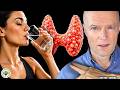 You Cannot Heal Your THYROID If You Do These 10 Things Daily DEFAULT Thumbnail