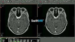 ED Trauma to ARIA Workup