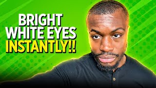 HOW TO GET BRIGHT EYES INSTANTLY! - Get Rid Of Red Eyes
