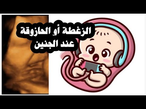 زغطة الجنين أو الحازوقة هل هي خطيرة كيف تميزها الحامل وكيف تعالجها