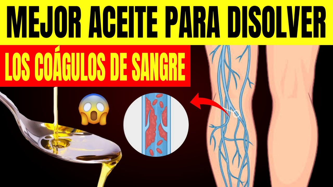 Derretir coágulos de sangre de forma natural: 6 aceites poderosos principales