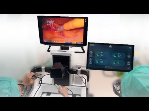 Robotic Sugery: Terobosan Pembedahan Modern dalam Penanganan Kanker 