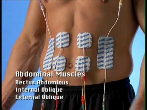 Compex Electrode Pad Placement Guide