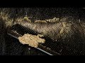 Satisfying Scalp Dandruff Removal Comb Scratching Big Flakes DKMOR2717