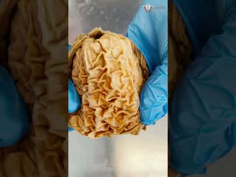 Looking Inside a Real Human Stomach | #shorts #food