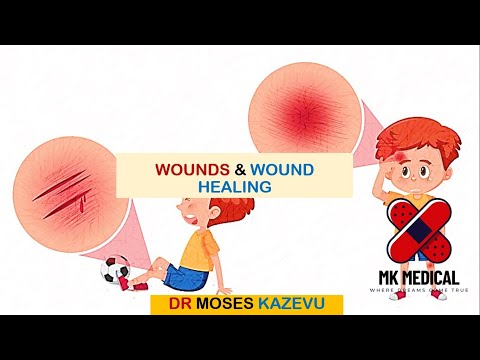 Wounds & Wound healing