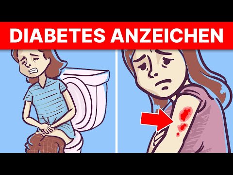 , title : '5 akute Anzeichen dafür, dass du Diabetes hast!'