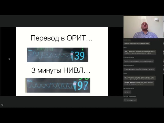 как узнать прикол видео что поражены легкие. Смотреть фото как узнать прикол видео что поражены легкие. Смотреть картинку как узнать прикол видео что поражены легкие. Картинка про как узнать прикол видео что поражены легкие. Фото как узнать прикол видео что поражены легкие