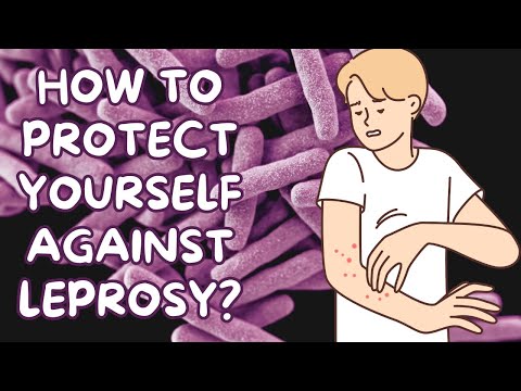 How to protect yourself from leprosy?