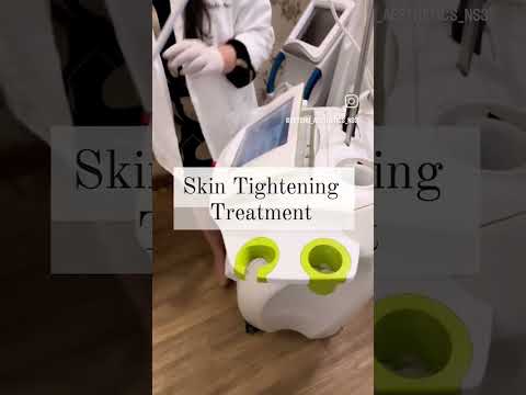 Skin Tightening Treatment