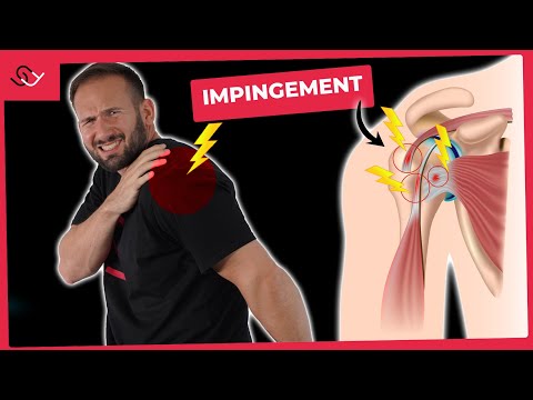 Schulterschmerzen - Diese einfachen Übungen helfen