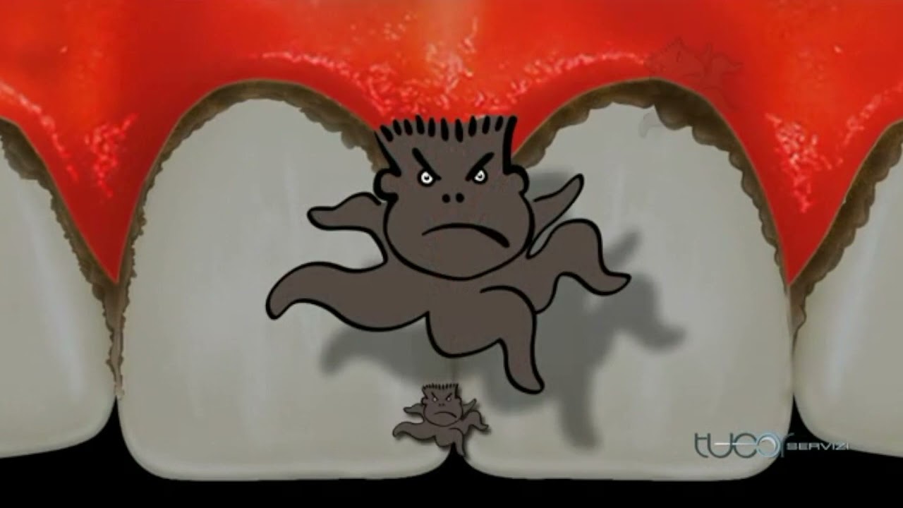 E che cos'é il tartato?