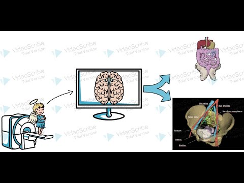 My PhD Thesis in 180 seconds - 3D reconstruction from Child's MRI using Machine Learning