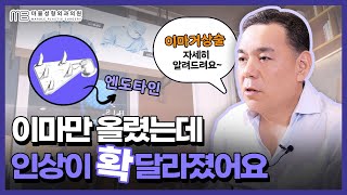이마거상술 궁금하셨죠? 수술법, 효과, 추천대상까지 싹 알려드립니다.