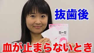 抜歯のあとに血が止まらないときの処置