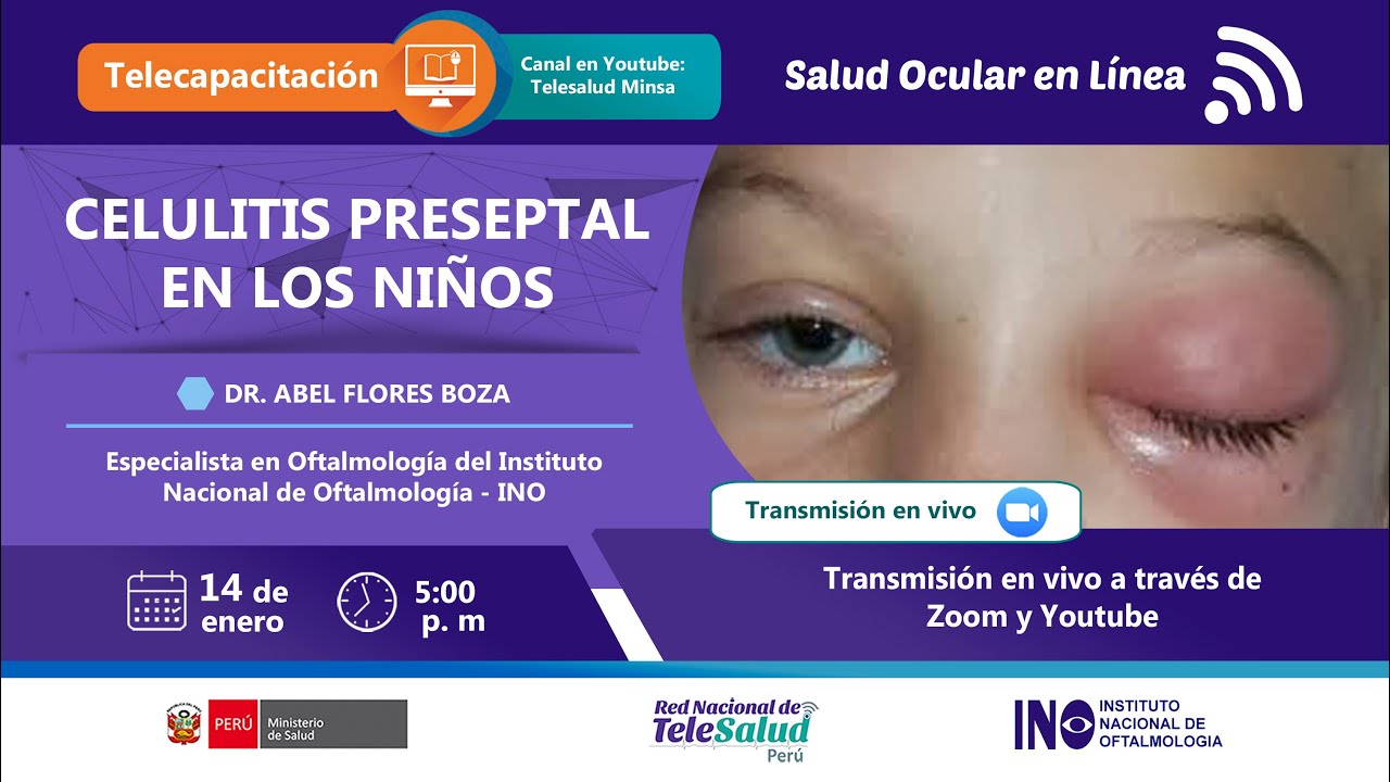 CELULITIS PRESEPTAL EN LOS NIÑOS - Salud Ocular en Línea del INO