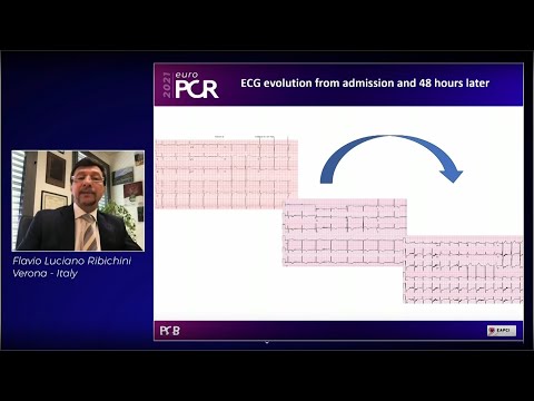Shock the rock: new intravascular lithotripsy real-world data and cases - EuroPCR 2021